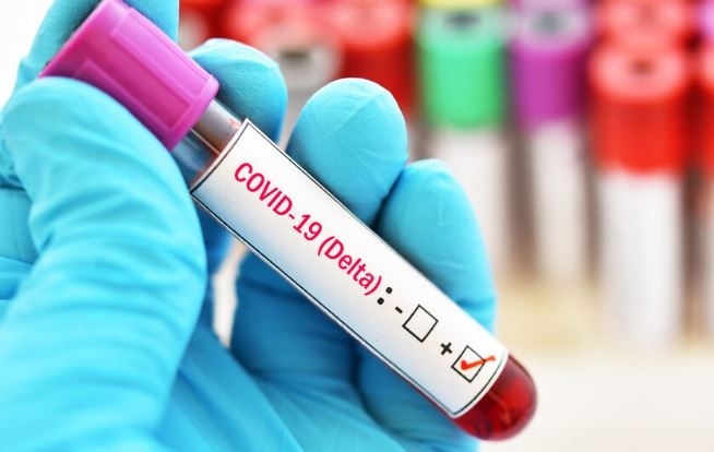 Нови 57 случая на Делта вариант у нас